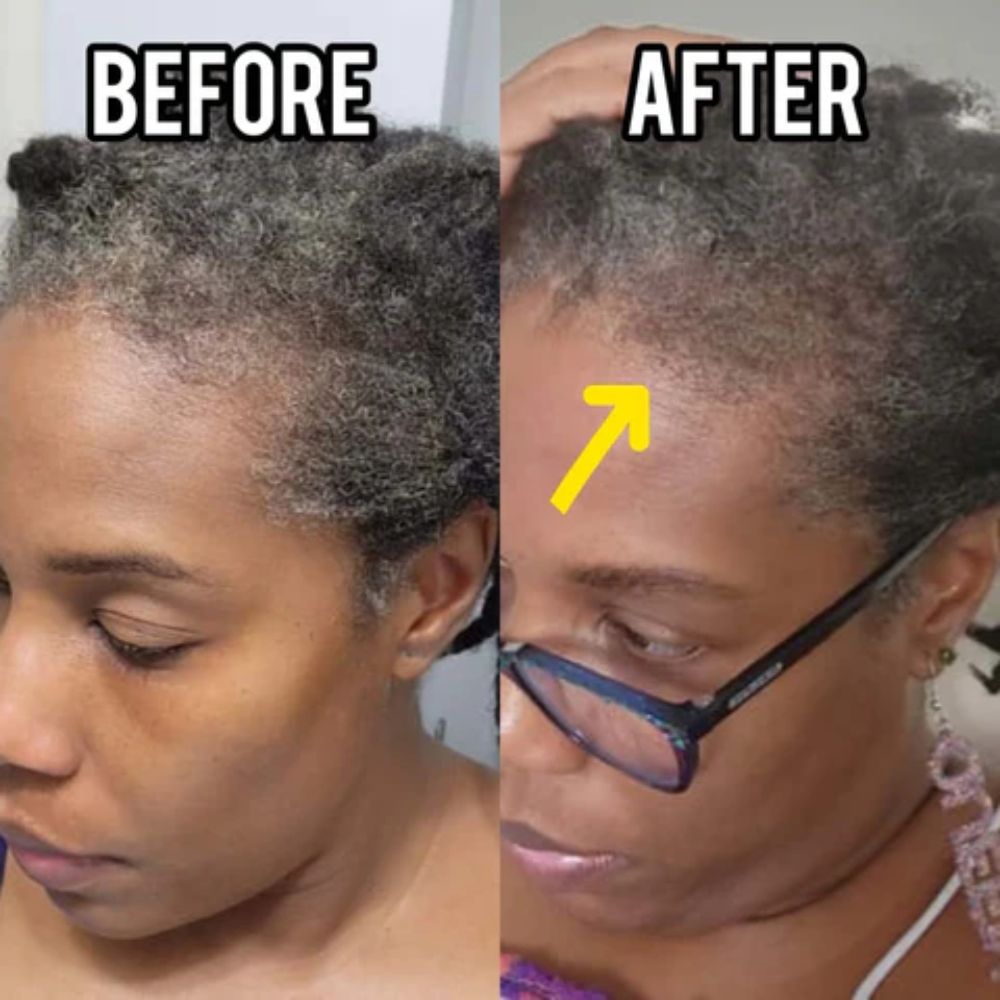 Stimulating Thickening Hair Growth Oil | Fix Thinning Hair