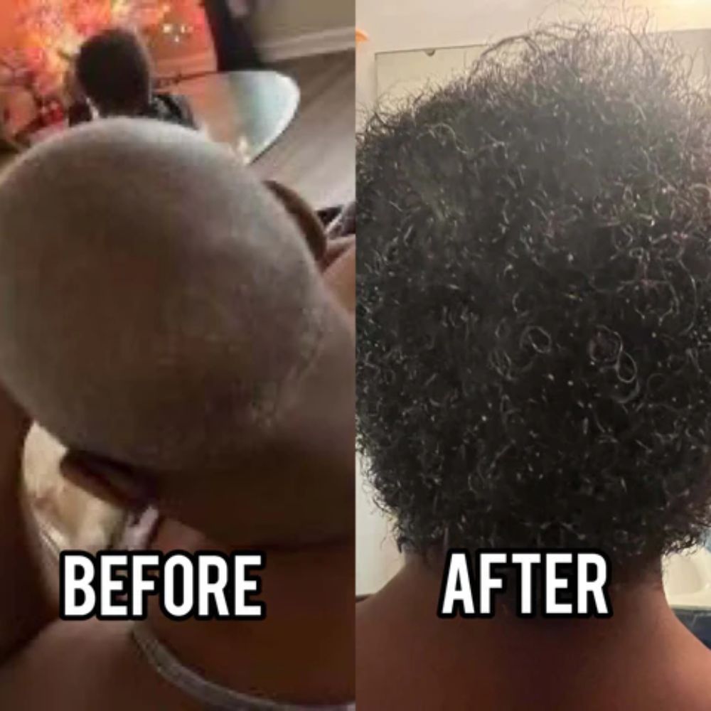 Grow Thicker, Stronger Hair Bundle | Fast Hair Growth