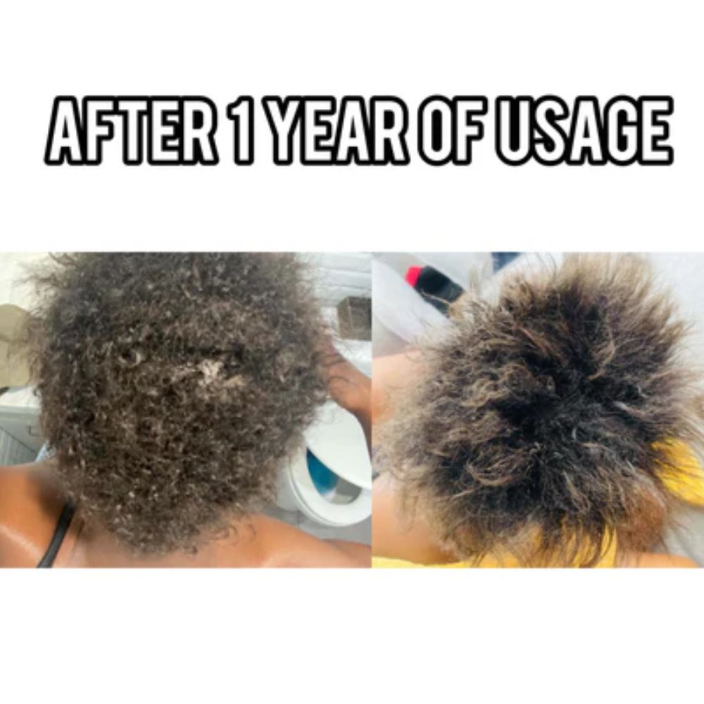 Stimulating Thickening Hair Growth Oil | Fix Thinning Hair