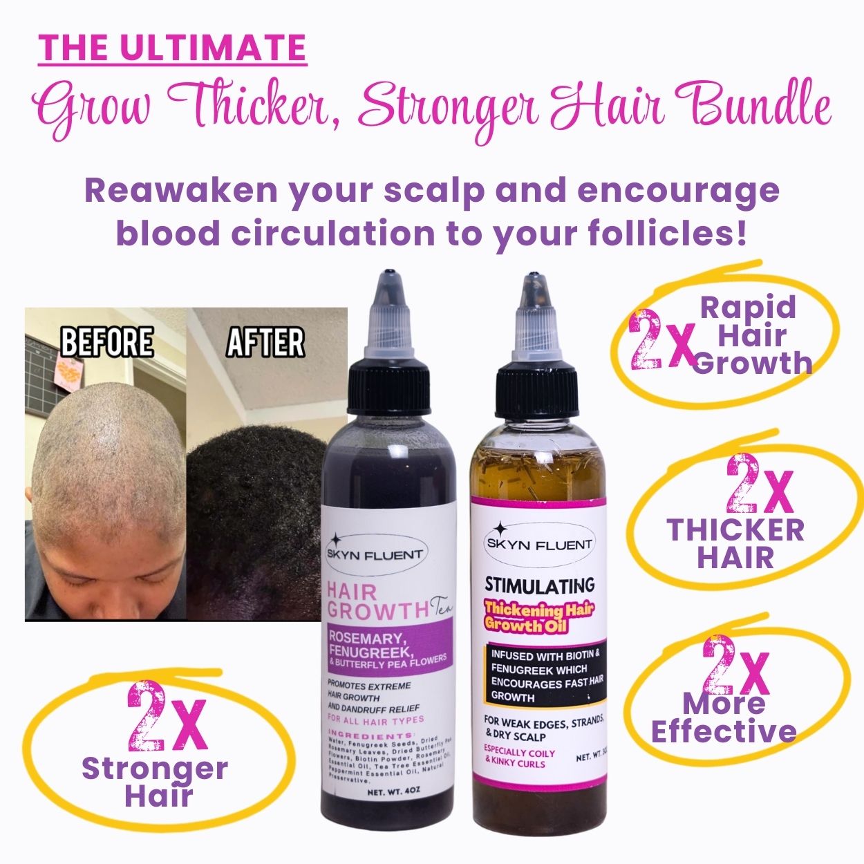 Grow Thicker, Stronger Hair Bundle | Fast Hair Growth