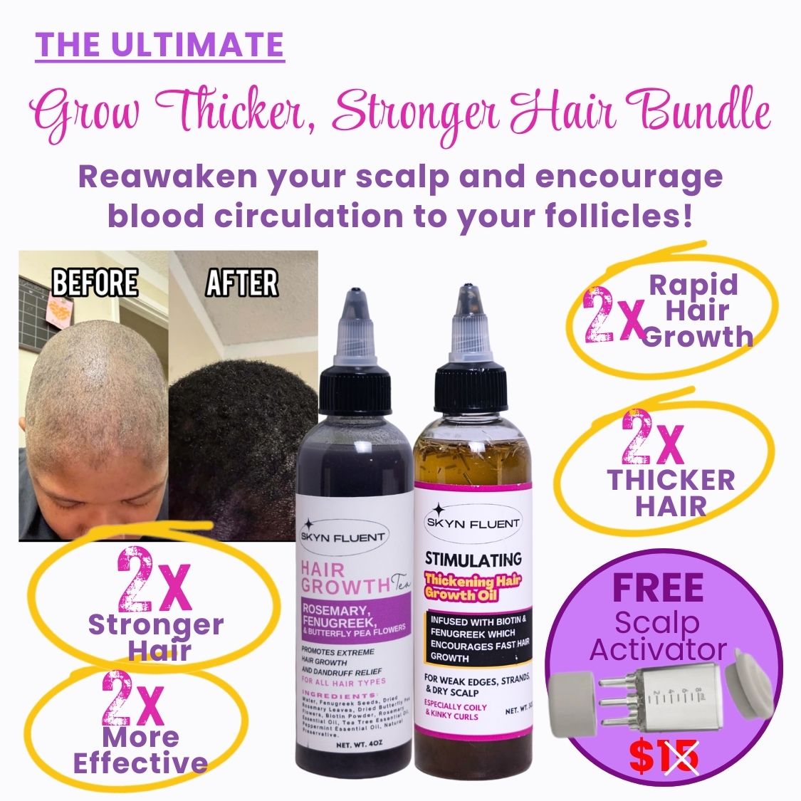 Grow Thicker, Stronger Hair Bundle