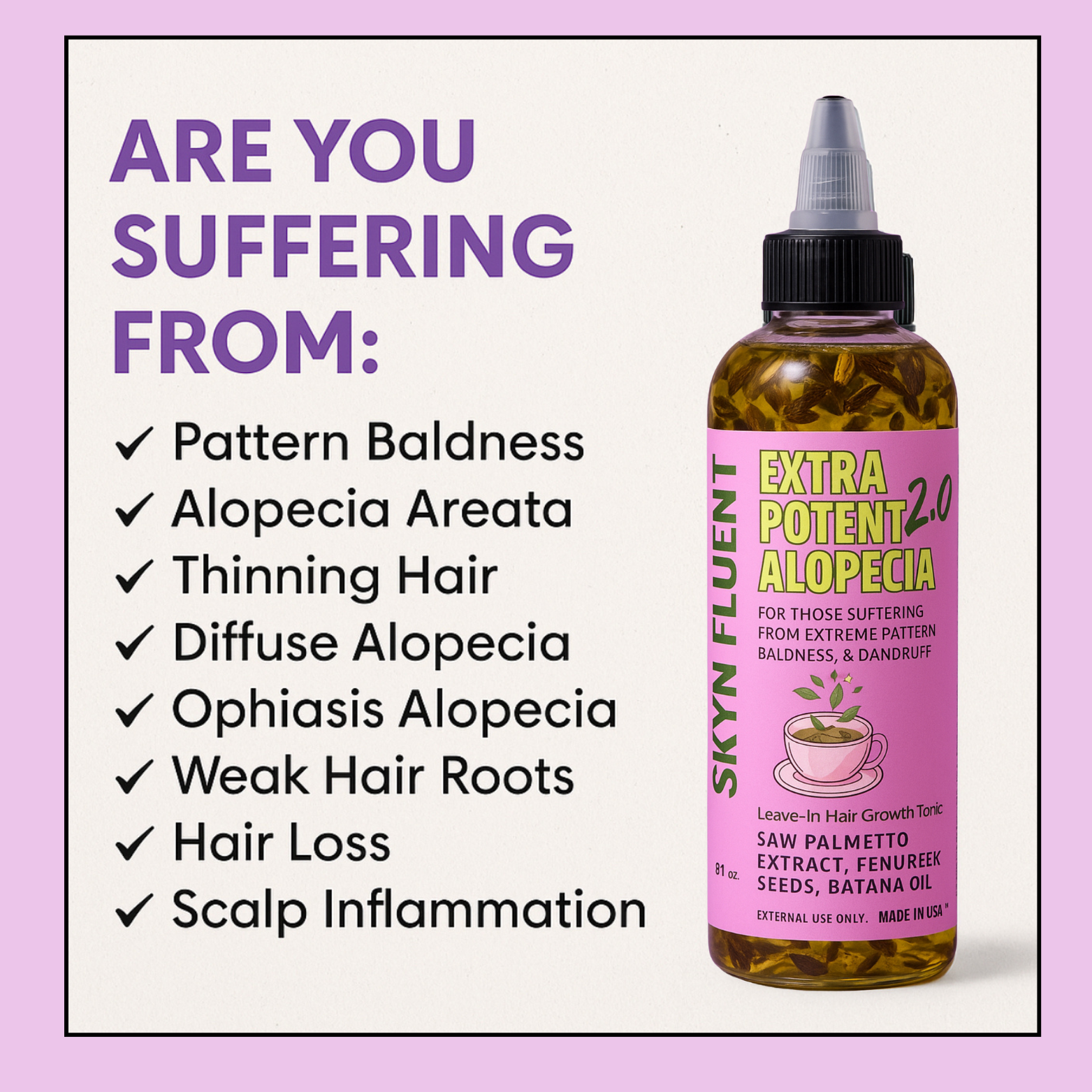 Skynfluent Extra Potent Alopecia Hair Growth Tonic for hair loss and bald spots – before and after results showing improved hair regrowth