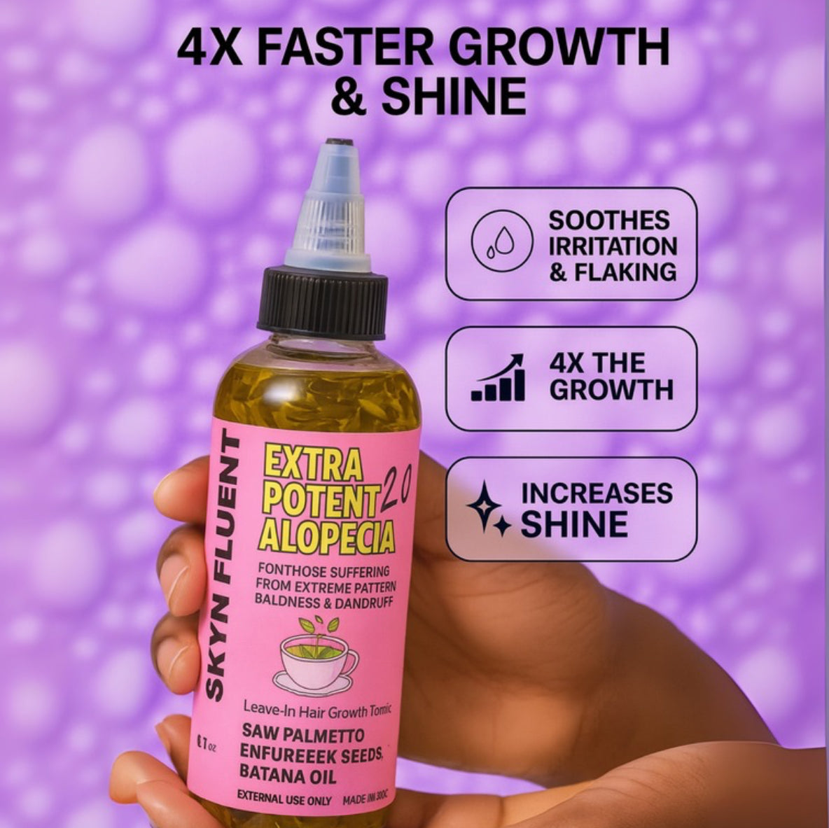 Skynfluent Extra Potent Alopecia Hair Growth Tonic promising 4X faster hair growth and shine – formulated to soothe irritation, reduce flaking, and increase shine